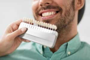 dentist with tooth color samples choosing shade for male patient teeth